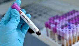 В Чеченской Республике за сутки выявили 9 случаев коронавируса