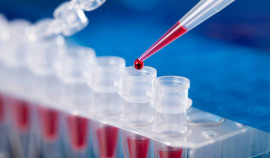 Более 100 жителей города Аргун приняли участие в акции «Ранняя диагностика — шаг к здоровью»