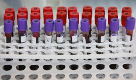 Число выявленных заражений коронавирусом в мире превысило 102,9 млн случаев