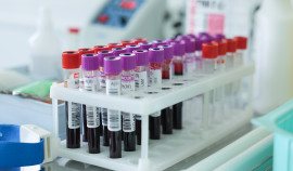 Около 120 000 жителей ЧР прошли диспансеризацию репродуктивного здоровья с 2025 года