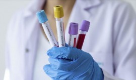 За сутки в России коронавирусом заразились 23 351 человек. Это минимум с 18 ноября